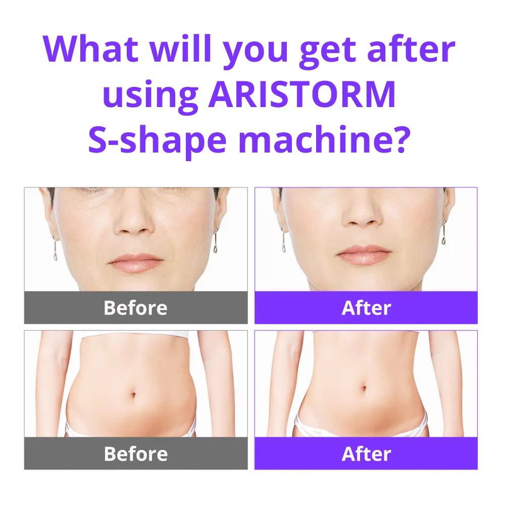 Skin Tightening Face Lift Body Sculpting Machine - Image 4